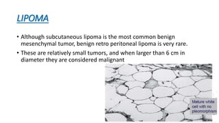 LIPOMA
• Although subcutaneous lipoma is the most common benign
mesenchymal tumor, benign retro peritoneal lipoma is very rare.
• These are relatively small tumors, and when larger than 6 cm in
diameter they are considered malignant
15
 