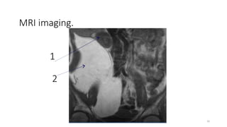 MRI imaging.
1
2
16
 