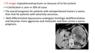 • CT images hypoattenuating lesion on because of its fat content.
• • Calcification is seen in 30% of cases
• The overall prognosis for patients with retroperitoneal tumors is worse
than that for patients with extremity sarcomas.
• Well-differentiated liposarcoma undergoes histologic dedifferentiation
and becomes more aggressive and metastatic and then carries a worse
prognosis.
22
 