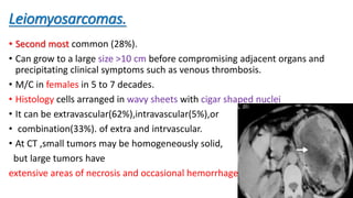 Leiomyosarcomas.
• Second most common (28%).
• Can grow to a large size >10 cm before compromising adjacent organs and
precipitating clinical symptoms such as venous thrombosis.
• M/C in females in 5 to 7 decades.
• Histology cells arranged in wavy sheets with cigar shaped nuclei
• It can be extravascular(62%),intravascular(5%),or
• combination(33%). of extra and intrvascular.
• At CT ,small tumors may be homogeneously solid,
but large tumors have
extensive areas of necrosis and occasional hemorrhage
28
 