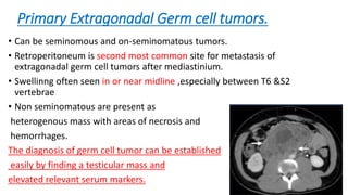 Primary Extragonadal Germ cell tumors.
• Can be seminomous and on-seminomatous tumors.
• Retroperitoneum is second most common site for metastasis of
extragonadal germ cell tumors after mediastinium.
• Swellinng often seen in or near midline ,especially between T6 &S2
vertebrae
• Non seminomatous are present as
heterogenous mass with areas of necrosis and
hemorrhages.
The diagnosis of germ cell tumor can be established
easily by finding a testicular mass and
elevated relevant serum markers. 32
 