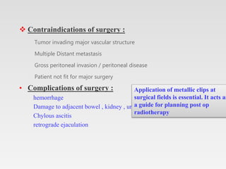  Contraindications of surgery :
Tumor invading major vascular structure
Multiple Distant metastasis
Gross peritoneal invasion / peritoneal disease
Patient not fit for major surgery
• Complications of surgery :
hemorrhage
Damage to adjacent bowel , kidney , ureter, nerve
Chylous ascitis
retrograde ejaculation
Application of metallic clips at
surgical fields is essential. It acts as
a guide for planning post op
radiotherapy
 