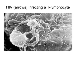 HIV (arrows) Infecting a T-lymphocyte
 