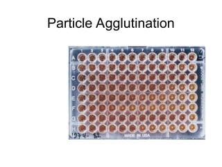 Particle Agglutination
 