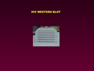 HIV WESTERN BLOT 