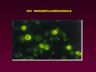 HIV  INMUNOFLUORESCENCIA 