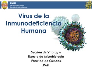 Sección de Virología
Escuela de Microbiología
Facultad de Ciencias
UNAH
UNAH
Facultad de Ciencias
Escuela de Microbiología
Virus de la
Inmunodeficiencia
Humana
 