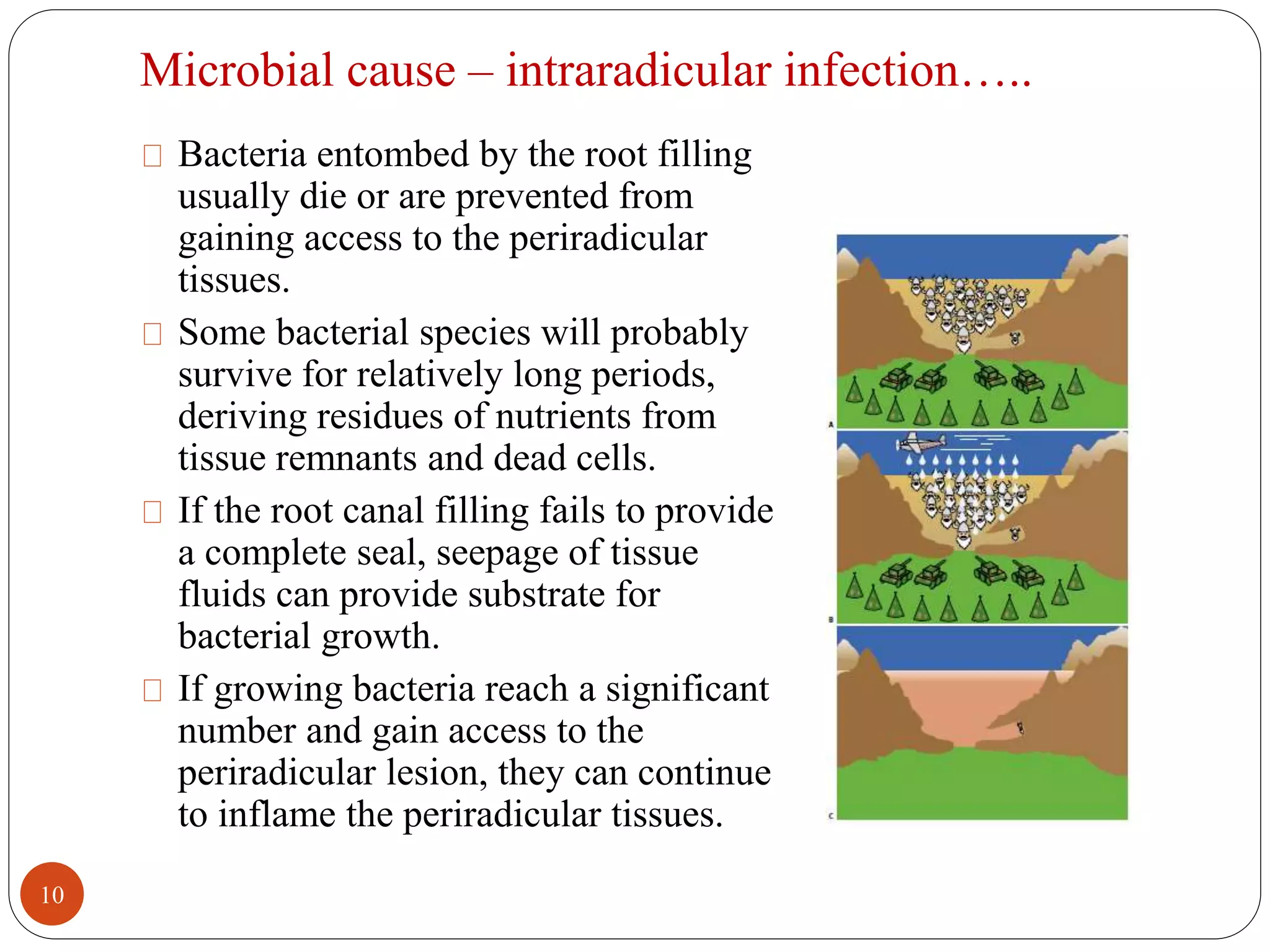 Microbial cause – intraradicular infection….. 
Bacteria entombed by the root filling 
usually die or are prevented from 
gaining access to the periradicular 
tissues. 
Some bacterial species will probably 
survive for relatively long periods, 
deriving residues of nutrients from 
tissue remnants and dead cells. 
If the root canal filling fails to provide 
a complete seal, seepage of tissue 
fluids can provide substrate for 
bacterial growth. 
If growing bacteria reach a significant 
number and gain access to the 
periradicular lesion, they can continue 
to inflame the periradicular tissues. 
10 
 