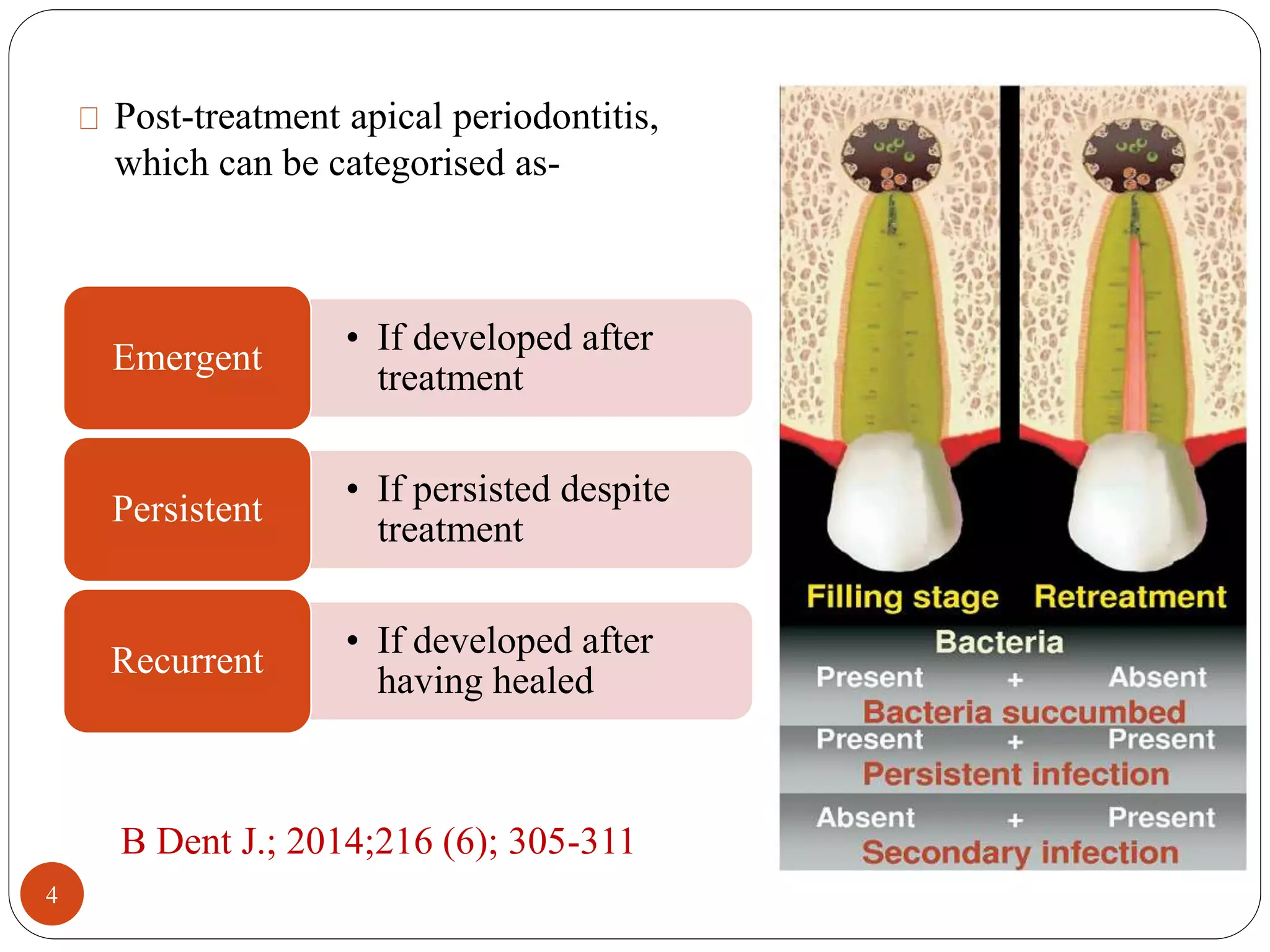 Post-treatment apical periodontitis, 
which can be categorised as- 
• If developed after 
treatment 
Emergent 
• If persisted despite 
treatment 
Persistent 
• If developed after 
having healed 
Recurrent 
B Dent J.; 2014;216 (6); 305-311 
4 
 