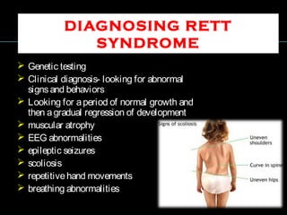 DIAGNOSING RETT
SYNDROME
 Genetic testing
 Clinical diagnosis- looking for abnormal
signsand behaviors
 Looking for aperiod of normal growth and
then agradual regression of development
 muscular atrophy
 EEG abnormalities
 epileptic seizures
 scoliosis
 repetitivehand movements
 breathing abnormalities
 