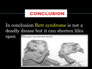 CONCLUSION
In conclusion Rett syndrome is not a
deadly diease but it can shorten lifes
span
 