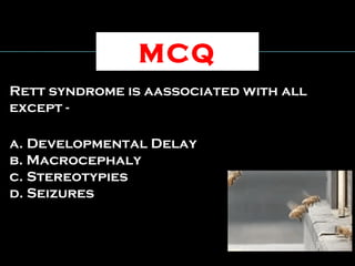 Rett syndrome is aassociated with all
except -
a. Developmental Delay
b. Macrocephaly
c. Stereotypies
d. Seizures
MCQ
 