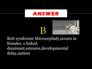 ANSWER
  B
Rett syndrome Microcephaly,occurs in
females, x linked
dominant,seizures,developmental
delay,autism
 
