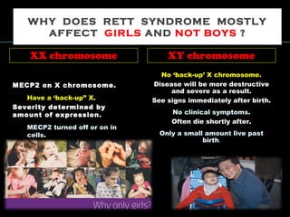 WHY DOES RETT SYNDROME MOSTLY
AFFECT GIRLS AND NOT BOYS ?
XX chromosome XY chromosome
MECP2 on X chromosome.
Have a ‘back-up” X.
Severity determined by
amount of expression.
MECP2 turned off or on in
cells.
No ‘back-up’ X chromosome.
Disease will be more destructive
and severe as a result.
See signs immediately after birth.
No clinical symptoms.
Often die shortly after.
Only a small amount live past
birth.
 