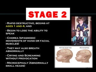 - Rapid destructive, begins at- Rapid destructive, begins at
ages 1 and 4ages 1 and 4, and, and
- Begin to lose the ability to- Begin to lose the ability to
speakspeak
- Chorea (spasmodic- Chorea (spasmodic
movements of hand or facialmovements of hand or facial
muscles)muscles)
- They may also breath- They may also breath
abnormallyabnormally
- Crying and Screaming- Crying and Screaming
without provocationwithout provocation
- Microcephaly (Abnormally- Microcephaly (Abnormally
small heads)small heads)
STAGE 2
 