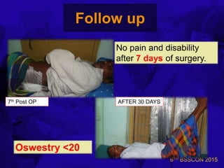 6TH BSSCON 2015
Follow up
7th Post OP AFTER 30 DAYS
No pain and disability
after 7 days of surgery.
Oswestry <20
 
