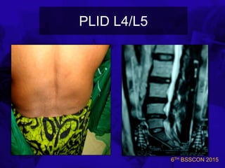 6TH BSSCON 2015
PLID L4/L5
 