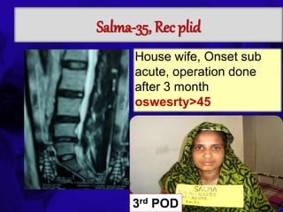 6TH BSSCON 2015
Salma-35, Rec plid
3rd POD
House wife, Onset sub
acute, operation done
after 3 month
oswesrty>45
 