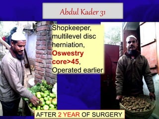 6TH BSSCON 2015
Abdul Kader 31
AFTER 2 YEAR OF SURGERY
Shopkeeper,
multilevel disc
herniation,
Oswestry
core>45,
Operated earlier
 