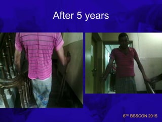 6TH BSSCON 2015
After 5 years
 