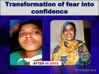 6TH BSSCON 2015
Transformation of fear into
confidence
AFTER 40 DAYS
 