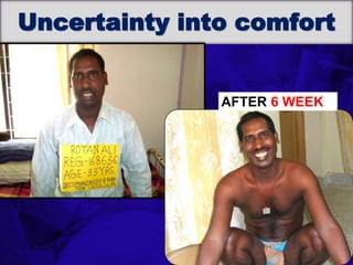 6TH BSSCON 2015
Uncertainty into comfort
AFTER 6 WEEK
 