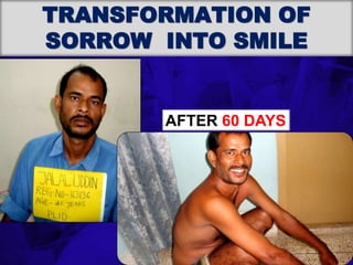 6TH BSSCON 2015
TRANSFORMATION OF
SORROW INTO SMILE
AFTER 60 DAYS
 