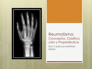 Reumatismo:
Conceptos, Clasifica
ción y Propedéutica
E.M. II José Luis Martínez
Garza
 