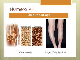 Numero VIII
            Óseos Y cartílago




    Osteoporosis         Paget (Osteoblastos)
 