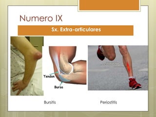 Numero IX
          Sx. Extra-articulares




     Bursitis                 Periostitis
 
