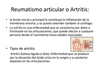 Reumatismo articular o Artritis:
• la lesión inicial y principal la constituye la inflamación de la
membrana sinovial, y se puede extender también al cartílago.
• La artritis es una enfermedad que se caracteriza por dolor e
hinchazón en las articulaciones, que puede afectar a cualquier
persona desde el nacimiento hasta edades avanzadas.
• Tipos de artritis:
Artritis Gotosa Aguda o Gota: Enfermedad que se produce
por la elevación del ácido úrico en la sangre y su posterior
depósito en las articulaciones.
 