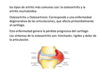 los tipos de artritis más comunes son: la osteoartritis y la
artritis reumatoidea.
Osteoartritis u Osteoartrosis: Corresponde a una enfermedad
degenerativa de las articulaciones, que afecta primordialmente
al cartílago.
Esta enfermedad genera la pérdida progresiva del cartílago.
Los síntomas de la osteoartritis son: hinchazón, rigidez y dolor de
la articulación.
 
