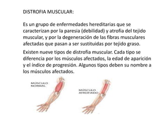 DISTROFIA MUSCULAR:
Es un grupo de enfermedades hereditarias que se
caracterizan por la paresia (debilidad) y atrofia del tejido
muscular, y por la degeneración de las fibras musculares
afectadas que pasan a ser sustituidas por tejido graso.
Existen nueve tipos de distrofia muscular. Cada tipo se
diferencia por los músculos afectados, la edad de aparición
y el índice de progresión. Algunos tipos deben su nombre a
los músculos afectados.
 
