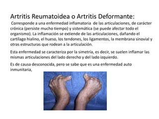 Artritis Reumatoidea o Artritis Deformante:
Corresponde a una enfermedad inflamatoria de las articulaciones, de carácter
c...