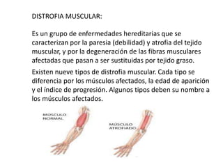 DISTROFIA MUSCULAR:
Es un grupo de enfermedades hereditarias que se
caracterizan por la paresia (debilidad) y atrofia del ...