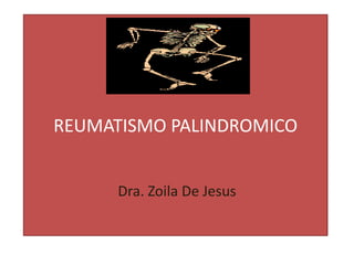 REUMATISMO PALINDROMICO


      Dra. Zoila De Jesus
 