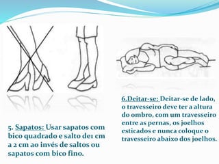 5. Sapatos: Usar sapatos com 
bico quadrado e salto de1 cm 
a 2 cm ao invés de saltos ou 
sapatos com bico fino. 
6.Deitar-se: Deitar-se de lado, 
o travesseiro deve ter a altura 
do ombro, com um travesseiro 
entre as pernas, os joelhos 
esticados e nunca coloque o 
travesseiro abaixo dos joelhos. 
 