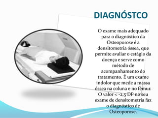 DIAGNÓSTCO 
O exame mais adequado 
para o diagnóstico da 
Osteoporose é a 
densitometria óssea, que 
permite avaliar o estágio da 
doença e serve como 
método de 
acompanhamento do 
tratamento. É um exame 
indolor que mede a massa 
óssea na coluna e no fêmur. 
O valor < -2,5 DP no seu 
exame de densitometria faz 
o diagnóstico de 
Osteoporose. 
 