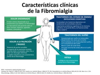 Características clínicas
de la Fibromialgia
REM = movimiento rápido del globo ocular.
Harding. Am J Med Sci. 1998;315:367-376; Leavitt et al. Arthritis Rheum. 1986;29:775-781; Roizenblatt et al. Arthritis Rheum.2001;44:222-230; Weir et al. J Clin
Rheumatology. 2006;12:124-128; Wolfe et al. Arthritis Rheum. 1990:33:160-172; Wolfe et al. Arthritis Rheum. 1995;38:19-28.
TRASTORNOS DEL ESTADO DE ÁNIMO/
DIFICULTADES COGNITIVAS
• La ansiedad y los trastornos depresivos son
condiciones de comorbidez comunes
• Importantes problemas cognitivos en la memoria
operativa, el recuerdo libre, y la fluencia verbal
(“fibro-niebla”)
FATIGA
• La fatiga es una característica
común de la Fibromialgia
DOLOR A LA PALPACIÓN
/ RIGIDEZ
• Presencia de puntos sensibles
• La mayoría de los pacientes también
reportan dolor a la presión, calor, frío, y
dolor con descargas eléctricas
• La rigidez matutina es una característica
común de la Fibromialgia
TRASTORNOS DEL SUEÑO
• Caracterizado por sueño no-restaurador,
despertando más veces por la noche
• Anormalidades en la continuidad del sueño y
en la arquitectura del sueño
• Menor sueño de onda-lenta
• Intrusión anormal de ondas alfa en el sueño
no-REM
DOLOR DISEMINADO
• El dolor crónico diseminado es la
característica que define a la Fibromialgia
• Los descriptores del paciente sobre el
dolor incluyen: doloroso, agotador,
molesto, y perjudicial
 