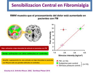 Amarillo: superposición (ie, area activada con baja intensidad en pacientes
con FM pero solo con grandes estimulos en controles)
Verde: activación con altos estímulos en controles
Rojo: activación a baja intensidad de estímulo en pacientes con FM
Gracely et al. Arthritis Rheum. 2002; Gentileza Pfeizer 2010
Sensibilizacion Central en Fibromialgia
RMNf muestra que el procesamiento del dolor está aumentado en
pacientes con FM
14
12
10
8
6
4
2
0
4.5
1.5 2.5 3.5
Stimulus intensity (kg/cm2)
Pain
intensity
FM (n=16)
Subjective pain control
Stimulus pressure control
(n=16)
 