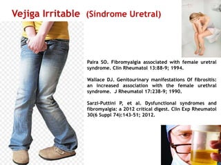 Paira SO. Fibromyalgia associated with female uretral
syndrome. Clin Rheumatol 13:88-9; 1994.
Wallace DJ. Genitourinary manifestations Of fibrositis:
an increased association with the female urethral
syndrome. J Rheumatol 17:238-9; 1990.
Sarzi-Puttini P, et al. Dysfunctional syndromes and
fibromyalgia: a 2012 critical digest. Clin Exp Rheumatol
30(6 Suppl 74):143-51; 2012.
Vejiga Irritable (Síndrome Uretral)
 