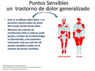 Puntos Sensibles
un trastorno de dolor generalizado
• Este es un dibujo sobre dolor—un
paciente colorea todas las áreas
del cuerpo donde siente dolor
• Mientras los criterios de
clasificación CAR se enfocan en18
puntos, el dolor de la Fibromialgia
es diseminado, y los pacientes
colorearán más que solo los 18
puntos sensibles usados en el
examen de puntos sensibles.
CAR= Colegio Americano de Reumatología.
Adaptado del dibujo de dolor proporcionado por cortesía de L Bateman.
Wolfe et al. Arthritis Rheum. 1990:33:160-172.
Frente
Lado Posterior
 
