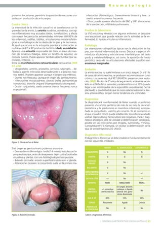 R e u m a t o l o g í a
proteínas bacterianas, permitiría la aparición de reacciones cruzadas con producción de anticuerpos.

Cuadro clínico
La intensidad de la infección causal no se correlaciona con la
gravedad de la artritis. La artritis es aditiva, asimétrica, con signos inflamatorios muy acusados (dolor, tumefacción), y afecta
con mayor frecuencia las extremidades inferiores (90-95% de
los enfermos), rodillas, tobillos, articulaciones metatarsofalángicas e interfalángicas de los dedos de los pies y de las manos.
Al igual que ocurre en la artropatía psoriásica la afectación simultánea de IFD e IFP produce la dactilitis o dedo en salchicha.
Aparece una entesitis responsable del dolor en áreas de inserción de tendones (talalgia, dolor en tendón de Aquiles), así
como la bursitis. Puede aparecer también dolor lumbar (por sacroileítis, entesitis…).
Entre las manifestaciones extraarticulares destacamos (MIR
03, 222):
- Urogenitales: uretritis, prostatitis, cervicitis, salpingitis… debidas al agente infeccioso desencadenante o al proceso reactivo estéril. (Pueden aparecer aunque el origen sea entérico).
- Diarrea no infecciosa, (aunque el origen sea genitourinario).
- Alteraciones mucocutáneas: úlceras orales (asintomáticas
transitorias), distrofia ungueal (hiperqueratosis subungueal).
- Ocular: conjuntivitis, uveítis anterior (menos frecuente, nunca
es posterior).

nifestación oftalmológica. Generalmente bilateral y leve. La
uveítis anterior es menos frecuente.
- Otras: puede aparecer afectación del SNC y SNP, alteraciones
de la conducción, infiltrados pulmonares…

Pruebas de laboratorio
La VSG está muy elevada y en algunos enfermos se descubre
una leucocitosis que guarda relación con la actividad de la enfermedad. El líquido articular es inflamatorio.

Radiología
Las alteraciones radiográficas típicas son la afectación de los
pies, con relativa indemnidad de manos. Destaca la especial afinidad por el calcáneo y articulaciones interfalángicas del dedo
gordo y metatarsofalángicas, así como, la aposición de hueso
perióstico cerca de las articulaciones afectadas (espolón) con
erosiones marginales.

Evolución
La artritis reactiva no suele limitarse a un único ataque. En el 61%
de casos de artritis reactiva, se producen recurrencias o un curso
crónico. Los pacientes HLA B27 (60-80%) presentan peor evolución (MIR). Al cabo de 15 años de seguimiento se observa sacroileítis en el 36% de los pacientes y sindesmofitos en el 10% (puede
llegar a ser indistinguible de la espondilitis anquilosante). Se ha
planteado la posibilidad de que los casos relacionados con la Yersinia enterocolítica, tengan menor tendencia a la cronicidad.

Diagnóstico
Se diagnosticará la enfermedad de Reiter cuando un enfermo
presente una artritis periférica de más de un mes de duración
(asimétrica y de predominio en miembros inferiores), acompañada de conjuntivitis, uretritis y/o cervicitis. En el momento en
el que el cuadro clínico queda establecido, los cultivos (exudado
uretral, coprocultivo y hemocultivo) son negativos. Para el diagnóstico etiológico será de utilidad la determinación serológica,
posible en las infecciones por Shigella, Salmonella, Yersinia,
Campylobacter y Chlamydia, sin olvidar la determinación de la
tasa de antiestreptolisina O (ASLO).

Diagnóstico diferencial
Figura 5. Úlcera oral en el Reiter.

El diagnóstico diferencial se debe establecer fundamentalmente
con las siguientes entidades:
A. GONOCÓCICA

A.PSORIÁSICA

CONJUNTIVITIS

Sí

No

Sí

UVEÍTIS

Sí

Sí

Sí

ÚLCERAS
ORALES

Sí

No

Sí

No

QUERATODERMIA
BLENORRÁGICA

Sí

No

+/-

SACROILEÍTIS

+/-

No

+/-

ARTRITIS

MMII

MMSS MMII

MMSS

CULTIVO,
GONOCOCO

+/- no excluye
artritis reactiva

En sangre, lesiones
cutáneas, o líquido
sinovial: enf. gonocócica diseminada

No

HLA B 27

80%

10%

50%

CURSO

Recurrente

Agudo

Crónico

RESPUESTA
A PENICILINA

Figura 6. Balanitis circinada.

REITER

BALANITIS

Si el origen es genitourinario podemos encontrar:
- Queratodermia blenorrágica: tardía (1-6 meses), vesículas con hiperqueratosis que, antes de desaparecer dejan costra localizadas
en palmas y plantas, con una histología de psoriasis pustular.
- Balanitis circinada: erosión superficial indolora en el glande.
- Alteraciones oculares: la conjuntivitis suele ser la primera ma-

No

Sí

No

Tabla 6. Diagnóstico diferencial.
] ESPONDILOARTROPATÍAS SERONEGATIVAS [ 43

 