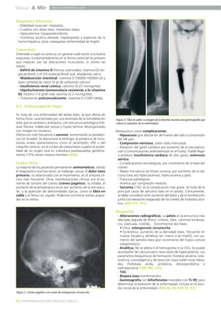 Manual A Mir

www.academiamir.com

Diagnóstico diferencial
- Debilidad muscular: miopatías.
- Cuadros con dolor óseo: metástasis óseas.
- Hipocalcemia: hipoparatiroidismo.
- Fosfatasa alcalina elevada: hepatopatías a expensas de la
forma hepática, otras osteopatías (enfermedad de Paget).

Tratamiento
Orientado a suplir la carencia; en general suele existir una buena
respuesta, fundamentalmente en la forma carencial (lo primero
que mejoran son las alteraciones musculares, lo último las
óseas).
- Déficit de vitamina D (formas carenciales): vitamina D2 (ergocalciferol) o vit D3 (colecalciferol) oral, añadiendo calcio.
- Malabsorción intestinal. vitamina D (50000-100000 UI) y
gran cantidad de calcio (4 gr de carbonato cálcico)
- Insuficiencia renal crónica: calcitriol (0.25 microgr/día)
- Hipofosfatemia (osteomalacia resistente a la vitamina
D): fósforo (1-4 gr/d) más calcitriol (0.2 microgr/día)
- Tratamiento anticonvulsivante: vitamina D (1000 UI/día).

8.3.- Enfermedad de Paget
Se trata de una enfermedad del tejido óseo, al que afecta de
forma focal, caracterizada por una anomalía de la remodelación
ósea que es excesiva y anárquica, con estructura patológica (médula fibrosa, trabéculas toscas y hueso laminar desorganizado
con imagen en mosaico).
Afecta con más frecuencia a varones, aumentando su prevalencia con la edad. Se desconoce la etiología: la presencia de inclusiones virales (paramixovirus como el sarampión, VRS o del
moquillo canino), en el núcleo de osteoclastos sugiere la posibilidad de un origen viral en individuos predispuestos genéticamente (15% tienen historia familiar) (MIR).

Cuadro clínico
La mayoría de los pacientes permanecen asintomáticos, siendo
el diagnóstico muchas veces un hallazgo casual. El dolor óseo
primario, no relacionado con el movimiento, es el síntoma clínico más frecuente. Otras manifestaciones clínicas son el aumento de tamaño del cráneo (cráneo pagético), la cefalea, el
aumento de la temperatura local, por aumento de la red vascular, y la aparición de deformidades típicas, como la tibia en
sable y el fémur en cayado. Podemos encontrar estrías angioides en la retina.

Figura 3. Tibia en sable. La imagen de la derecha muestra una gammagrafía que
valora la extensión de la enfermedad.

Destacamos como complicaciones:
- Hipoacusia (por afectación de huesos del oído o compresión
del VIII par).
- Compresión nerviosa, sobre todo intercostal.
- Elevación del gasto cardíaco por aumento de la vascularización y comunicaciones arteriovenosas en el hueso. Puede llegar
a producir insuficiencia cardíaca de alto gasto, estenosis
aórtica.
- Complicaciones neurológicas, por crecimiento de la base del
cráneo.
- Mayor frecuencia de litiasis urinaria, por aumento de la calciuria (rara vez hipercalcemia), hiperuricemia y gota.
- Fracturas patológicas.
- Anemia por compresión medular.
- Sarcoma (1%): es la complicación más grave. Se trata de la
principal causa de sarcoma óseo en el adulto. Clínicamente,
se debe considerar ante aumento del dolor y de la tumefacción
junto con elevación exagerada de los niveles de fosfatasa alcalina (MIR 97F, 101).

Diagnóstico
- Alteraciones radiográficas. La pelvis es la estructura más
afectada seguida de fémur, cráneo, tibia, columna lumbosacra, clavículas, costillas… Encontramos dos fases:
• Lítica: osteoporosis circunscrita.
• Esclerótica: aumento de la densidad ósea, frecuente en
huesos faciales y vértebras (en marco o en marfil), con aumento del tamaño óseo (por incremento del hueso cortical
subperióstico).
- Analítica. No se altera ni el hemograma ni la VSG. Se puede
acompañar de calciuria pero raras veces de hipercalcemia. Los
parámetros bioquímicos de formación (fosfatas alcalina, osteocalcina, procolágeno) y de resorción ósea suelen estar elevados (fosfatasa ácida, piridolina, desoxipiridolina e
hidroxiprolina) (MIR 98F, 215).
- TAC.
- Biopsia ósea (confirmación).
- Gammagrafía con bifosfonatos marcados con Tc-99, para
determinar la extensión de la enfermedad, incluso en el estudio inicial de la enfermedad (MIR 06, 89; MIR 02, 81).
Figura 2. Cráneo pagético con zonas de osteoporosis circunscrita.

48 ] ENFERMEDADES METABÓLICAS ÓSEAS [

 