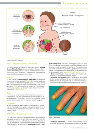 R e u m a t o l o g í a

Dx: clínico
Epiescleritis,
conjuntivitis y
uveitis

Tratamiento: esteroides ± inmunosupresores

Condritis auricular
Lo más característico y frecuente
Condritis nasal
Afectación de
cartílago respiratorio
(ronquera, estridor)

Insuficiencia aórtica y
aneurismas de aorta ascendente

Artritis de
articulaciones
paraesternales

Vasculitis
cutánea

Figura 1. Policondritis recidivante.

12.2.- Artropatía neuropática de Charcot
Es una forma grave de osteoartritis que se asocia a una pérdida
de sensibilidad al dolor, propioceptiva o ambas, con disminución de los reflejos musculares. Sin estos mecanismos las articulaciones están sometidas a traumatismos repetidos que
causan una lesión progresiva del cartílago.

Etiología
En la actualidad la polineuropatía diabética es la causa más
frecuente a nivel del tarso y MTF (MIR). En niños la causa más
frecuente es el mielomeningocele. Otras causas son: tabes
dorsal, siringomielia (con afectación glenohumeral, del codo y
del carpo) (MIR), la amiloidosis, la lepra o las inyecciones intraarticulares repetidas de glucocorticoides. No aparece en el hipotiroidismo (MIR 00F, 95).

plasias de pulmón (carcinoma broncogénico y pleural), infecciones pulmonares, fibrosis quística, sarcoidosis, neumonitis intersticial crónica, cardiopatía congénita con shunt de derecha a
izquierda, cor pulmonale, neoplasias gastrointestinales, enfermedad inflamatoria intestinal, endocarditis bacteriana subaguda
(S. viridans sobre todo), etc. (MIR 97, 107; MIR 97F, 96).
- Síndrome articular. Cursa con dolor, tumefacción y derrame en las grandes articulaciones distales.
- Síndrome morfológico. Hay una deformación de los dedos
de las manos y de los pies, con una incurvación de la uña, en
forma de vidrio de reloj, junto con un ensanchamiento de la
falange terminal (acropaquia o dedos en palillo de tambor).

Clínica
La articulación aumenta de tamaño, como consecuencia del crecimiento óseo y del derrrame sinovial. Conforme progresa la enfermedad aparece inestabilidad, subluxación y crepitación: lo más
característico es que el dolor es inferior al que cabría esperar.

Tratamiento
Se basa en estabilizar la articulación (soportes externos, férulas).
Está contraindicado el reemplazamiento articular por prótesis. El
tratamiento de la enfermedad causal NO suele alterar la enfermedad articular.

12.3.- Osteoartropatía hipertrófica
Esta afección se manifiesta generalmente en la edad media de
la vida y se caracteriza por una hipertrofia de manos y pies. Diferenciamos una forma primaria, que puede ser idiopática o
más frecuentemente, familiar (enfermedad de Touraine-SolenteCalvé de herencia AD) y una forma secundaria asociada a neo-

Figura 2. Acropaquias.

- Síndrome radiológico. La primera exploración a realizar es
la Rx tórax. A nivel óseo, las diáfisis afectas aparecen recubier] OTRAS ARTROPATÍAS [ 57

 