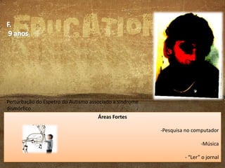 Perturbação do Espetro do Autismo associado a síndrome
dismórfico
Áreas Fortes
Perturbação da Comunicação e da Linguagem
Em avaliação pela Genética

-Pesquisa no computador
-Música
- “Ler” o jornal

 