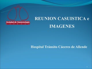 REUNION CASUISTICA e
C   O   R   D   O   B   A

                                       IMAGENES



                            Hospital Tránsito Cáceres de Allende




                                                               1
 