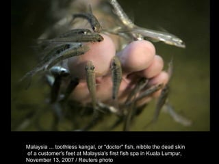 Malaysia ... toothless kangal, or "doctor" fish, nibble the dead skin of a customer's feet at Malaysia's first fish spa in Kuala Lumpur,  November 13, 2007 / Reuters photo  