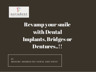 B Y
N O V A D E N T A D V A N C E D P O L Y D E N T A L C A R E C E N T E R
Revamp your smile
with Dental
Implants, Bridges or
Dentures..!!
 