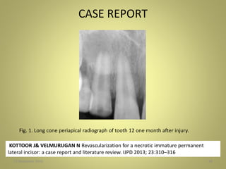 CASE REPORT
27 November 2016 58
KOTTOOR J& VELMURUGAN N Revascularization for a necrotic immature permanent
lateral incisor: a case report and literature review. IJPD 2013; 23:310–316
Fig. 1. Long cone periapical radiograph of tooth 12 one month after injury.
 